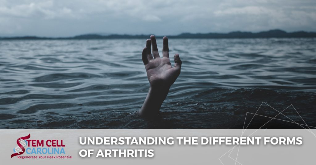 understanding the different forms of arthritis