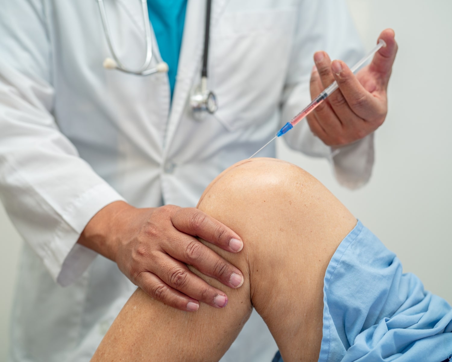 Stem Cell Treatment