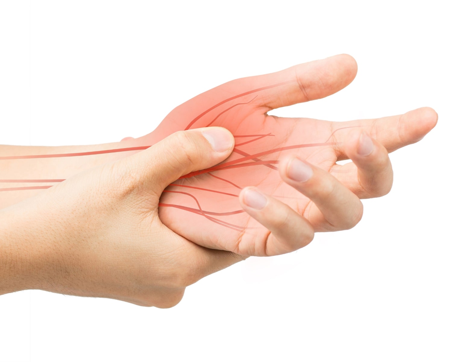 Nerve Hydrodissection