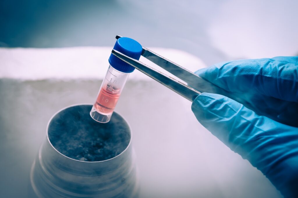 Stem cell therapy sample being processed at a regenerative medicine clinic in Charlotte NC